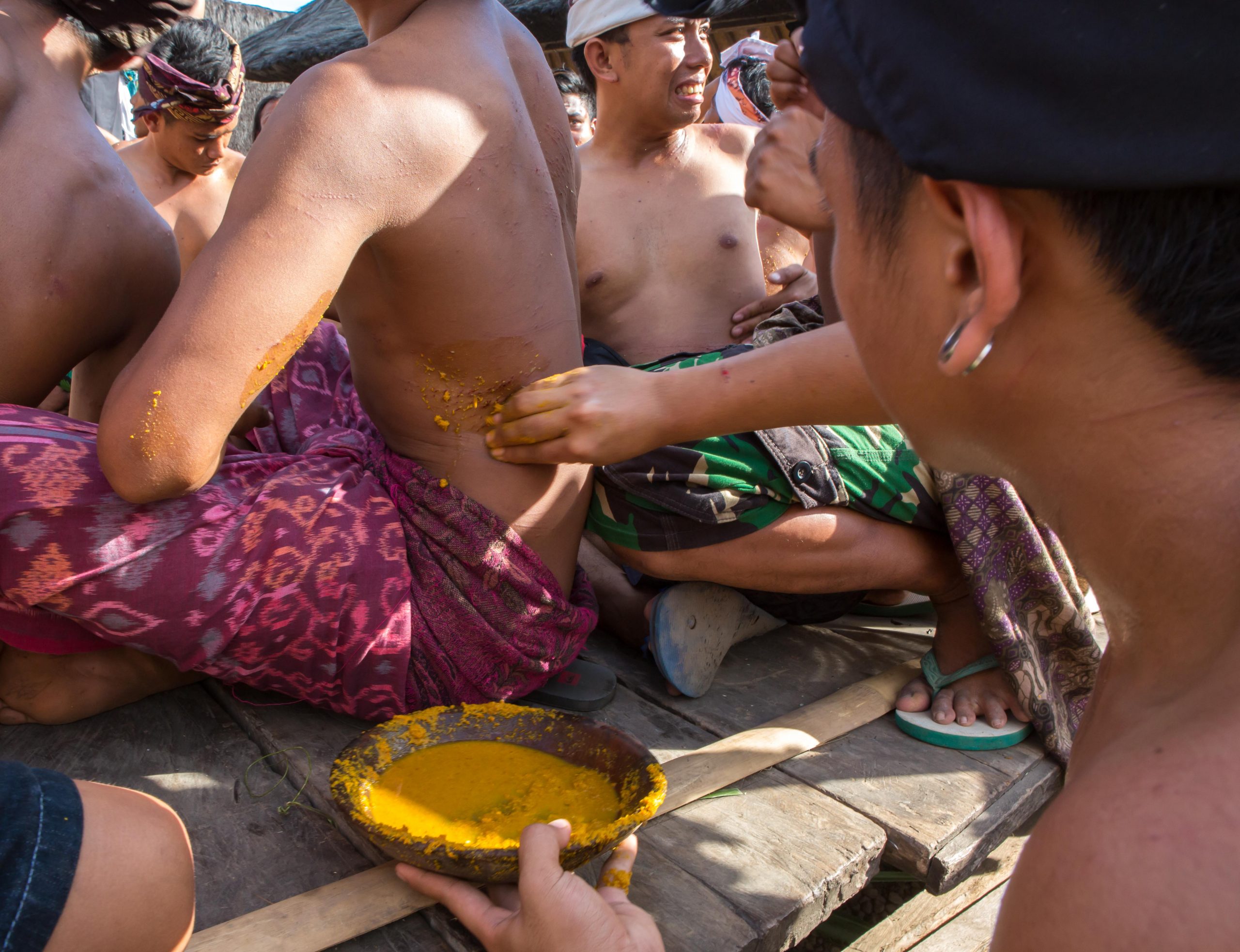 Balinese herbal medicine used to treat Mekare-kare pandan war wounds